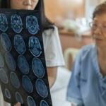 research for cause of Alzheimer's disease