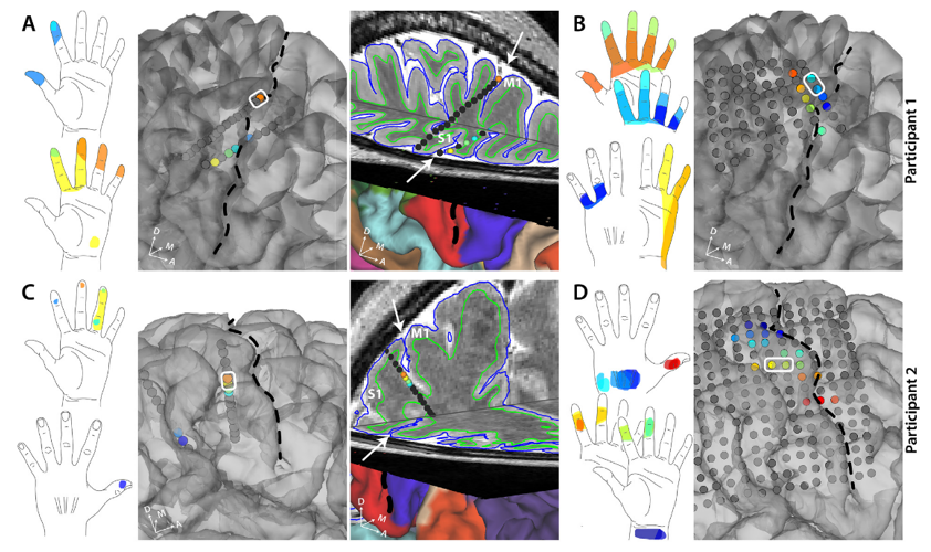 correspondence between different areas of the brain with sensory feeling in the hand