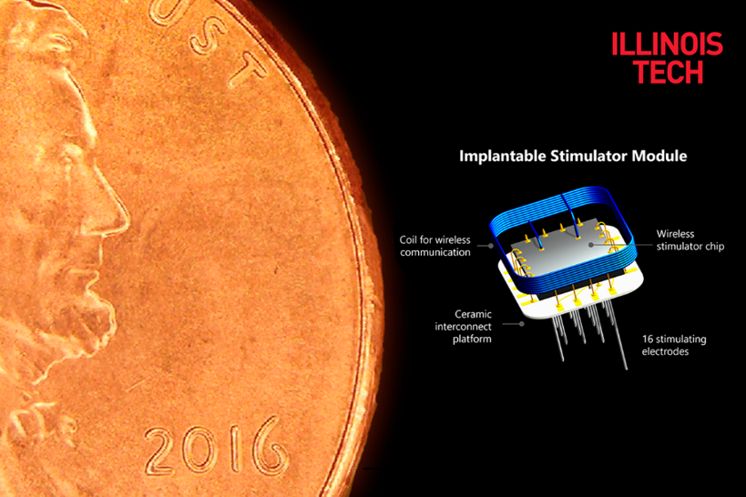 implantable stimulator module