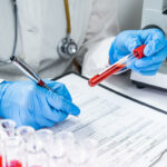 blood test for cancer diagnosis laboratory
