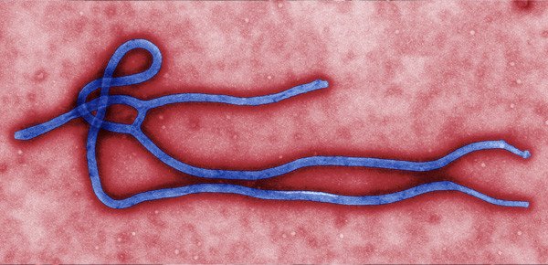 Formaspace-Ebola-Virus-colorized-TEM
